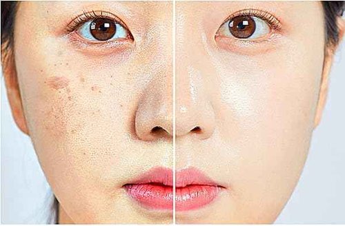 WHITESILK (85%) Human Stem Cell & (10%) PDRN Anti-Aging & Repair Ampoule Serum (12 Vials, 120ml) for Youthful, Radiant Skin!