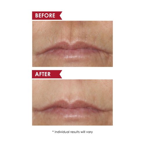 Dermelect Professional Power Stars targeted solutions duo