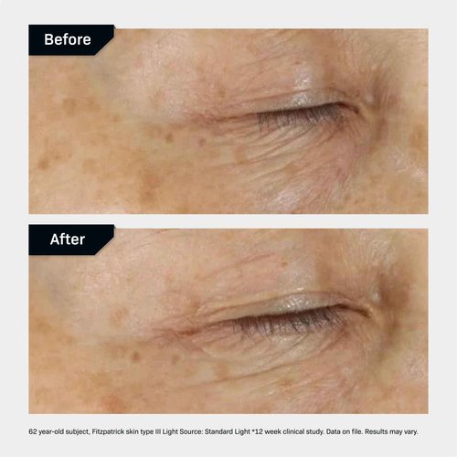 Revision Skincare D·E·J Eye Cream®, Clinically Proven to Reduce Under-Eye Fine Lines and Wrinkles with Peptides and Hyaluronic Acid for a Firmer, Smoother Eye Area, 0.25 fl oz