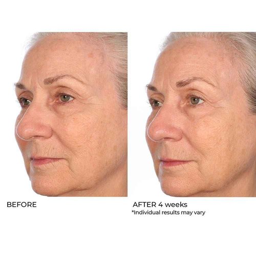 NassifMD Pro Peptide Collagen Serum, Clinical Grade with Premium Ingredients for Hydrated Smooth Skin, Lightweight Fast-Absorbing Anti-Aging Formula for Softer Texture and Healthy Glow, 1 oz