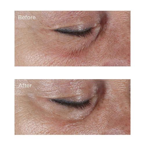 Perricone MD Hypoallergenic Firming Eye Cream, New - 0.5 oz