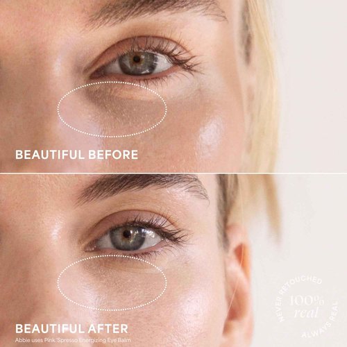 TULA Skin Care Eye Balm Extravaganza - Dark Circle Under Eye Treatment, Instantly Hydrate and Brighten Undereye Area & Leave the Ultimate Glow, 3-Piece Kit