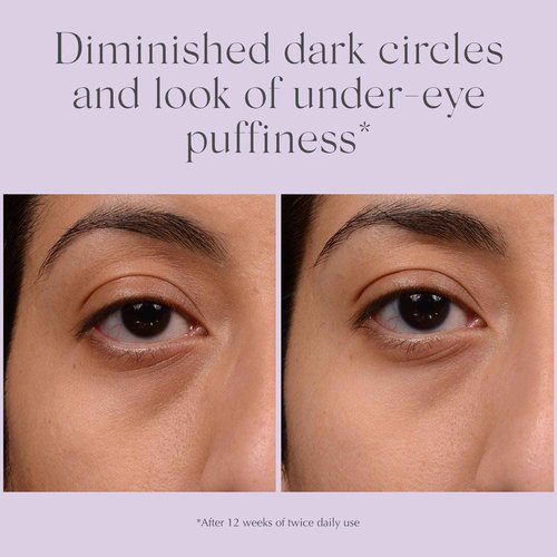 EXUVIANCE Bright Eyes Dark Circle Corrector Hydrating Eye Cream with Algae Extracts, Peptides, Polyhydroxy + Bionic Acids, Fragrance-Free, 15 g.