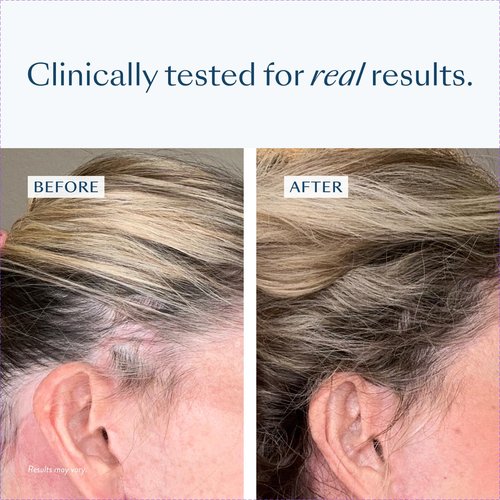 eSalon Densifying Scalp Serum with Procapil and Redensyl, 1 fl oz