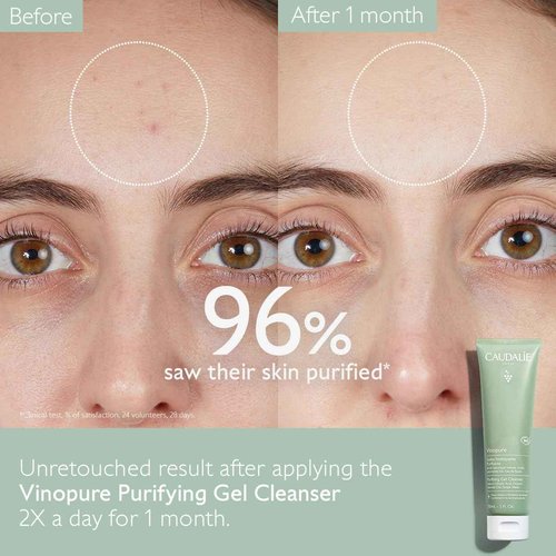 Caudalie Vinopure Acne-Prone Skin Trio, Skin Perfecting Serum 30 mL, Purifying Gel Cleanser 75 mL, and Salicylic Spot Solution 15 mL