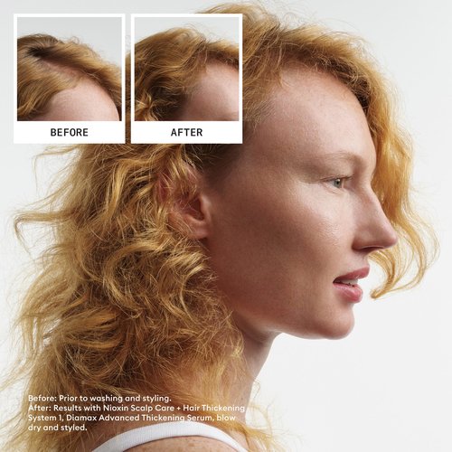 Nioxin System Kit 1 + Thickening Spray, For Natural Hair with Light Thinning, Full Size (3 Month Supply)